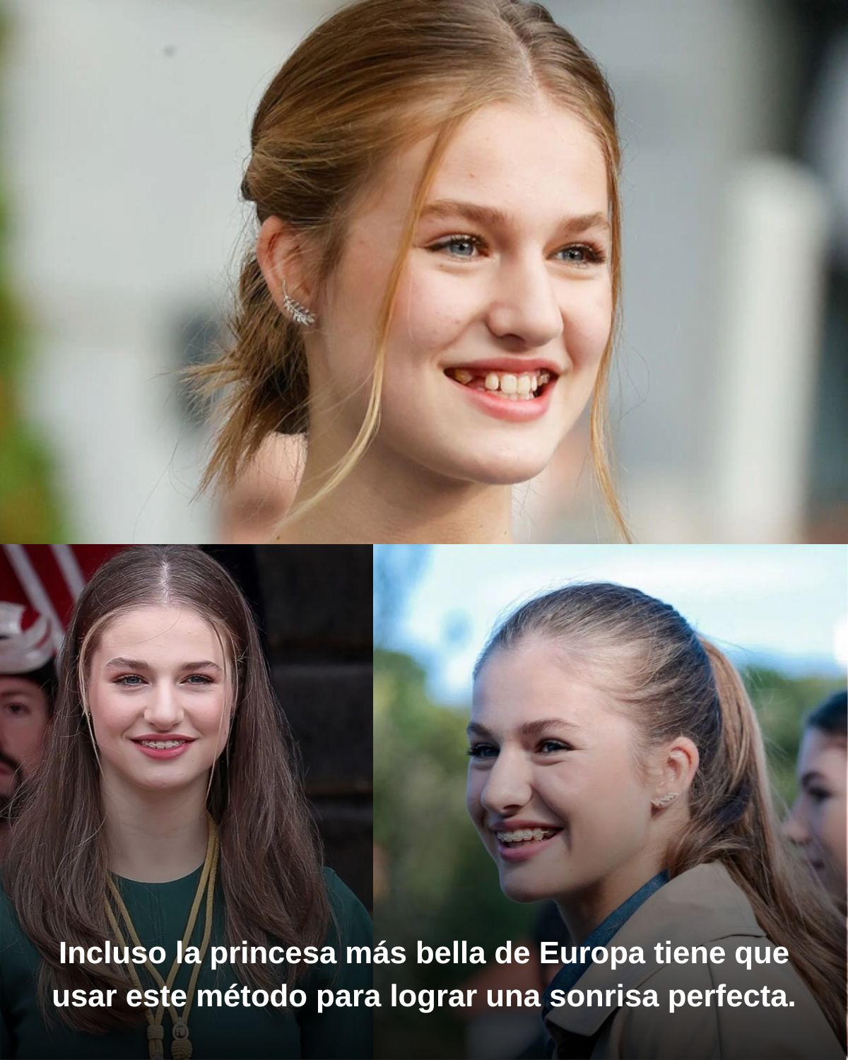 Incluso la princesa más bella de Europa tiene que usar este método para lograr una sonrisa perfecta.